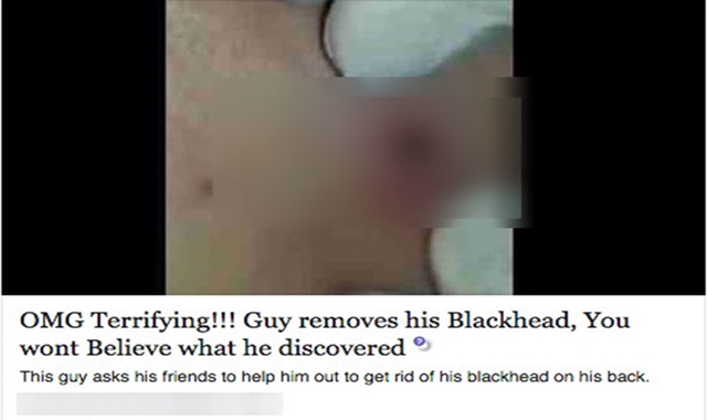 guy-removes-blackhead-facebook-malware-1