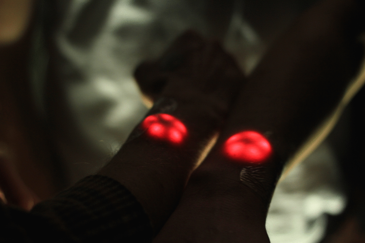 Human biology combines with technology as "Biohackers" implant LEDs into their hands