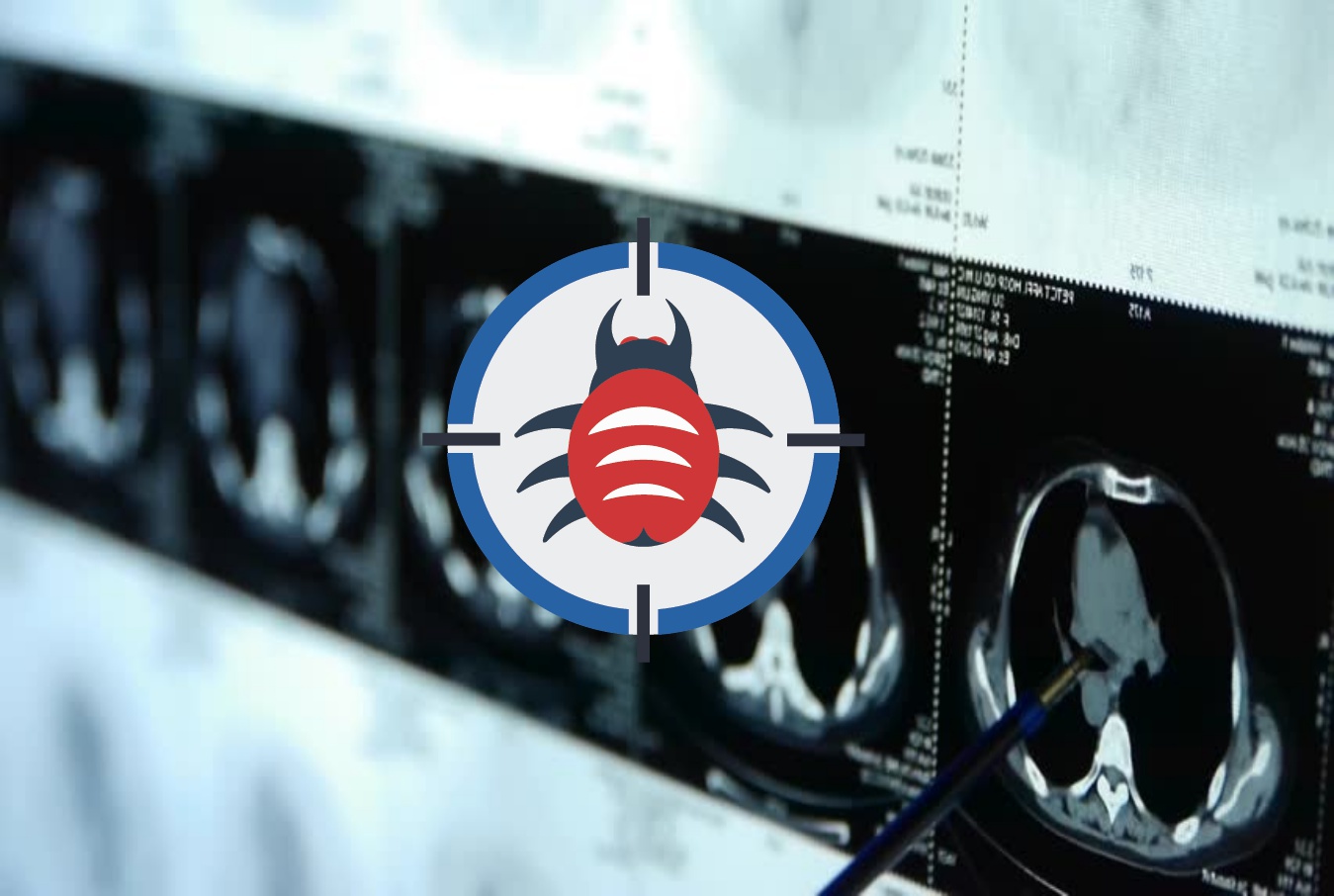 New malware can modify CT and MRI scan results